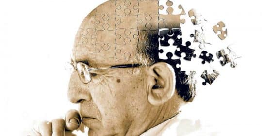 Frequently Asked Questions About Alzheimer’s Disease