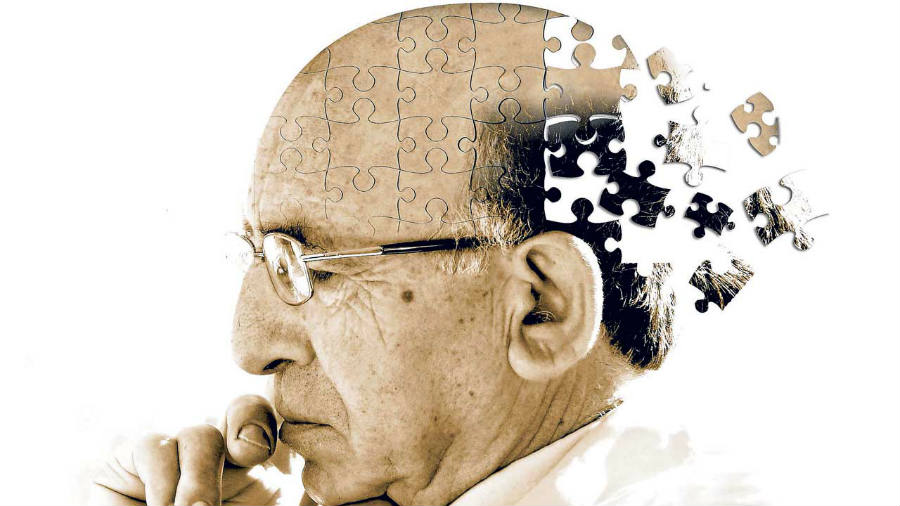 FAQ Alzheimer disease