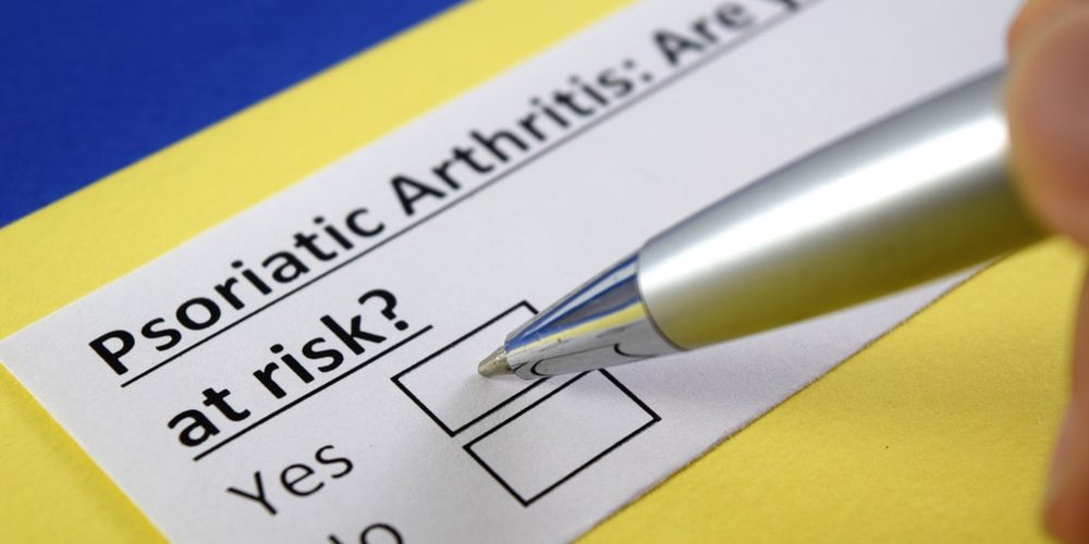 Psoriatic Arthritis Recognizing symptoms for psoriatic arthritis