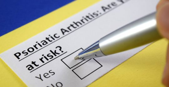 Psoriatic Arthritis Symptoms, Causes, and Self-Management