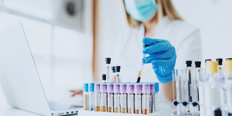 lab-tests Semaglutide weight loss