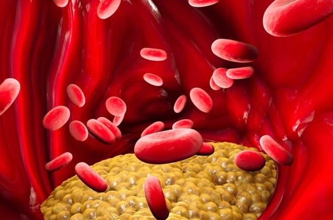 lipoprotein cholesterol